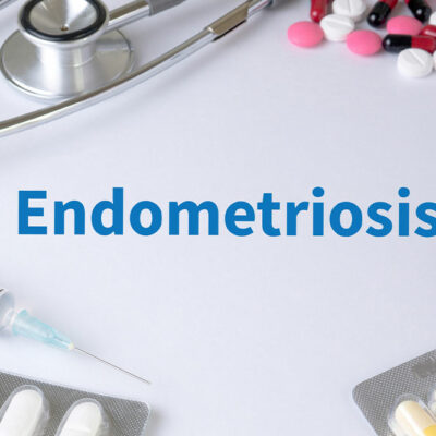 Endometriosis – Symptoms and natural remedies